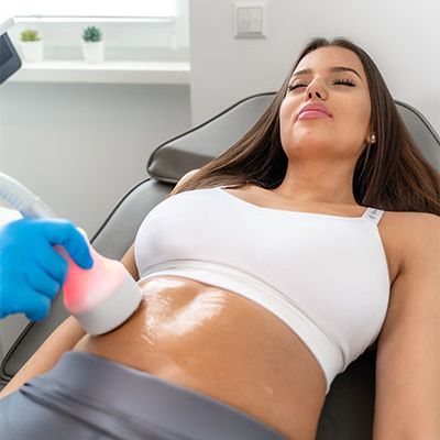 Cryoshaper